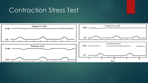 equivocal stress test meaning